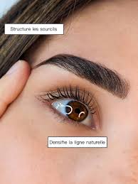 Brow lift